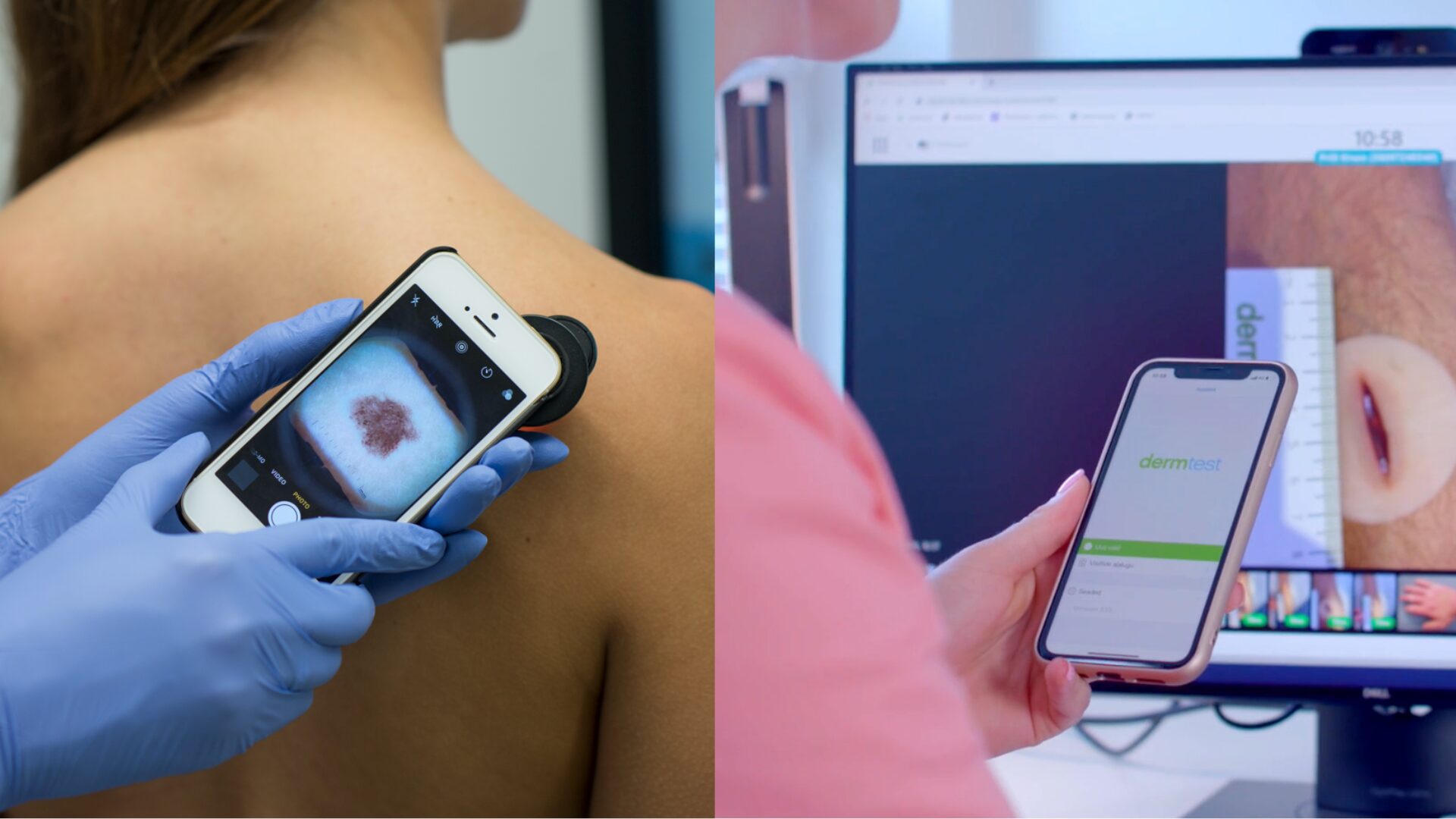North Estonia Medical Centre (Põhja-Eesti Regionaalhaigla) adopts Dermtest Pildivaatur in plastic surgery